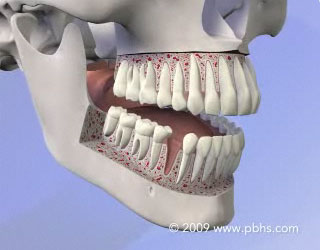 Dental Implants Illustration